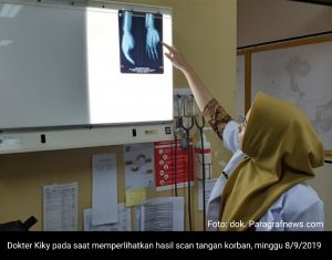 Ibu Jari Putus Akibat Terkaman Buaya, Korban di Larikan ke RS di Samarinda