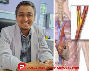 Alami Gejala Angin Duduk Atau Serangan Jantung, dr. Suhardi : Segera Check Up Ke Rumah Sakit