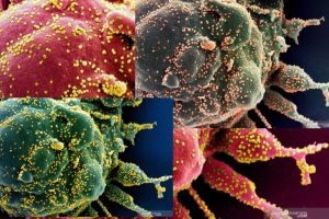 Penampakan Gambar Virus Corona yang Diambil dari Sampel Pasien