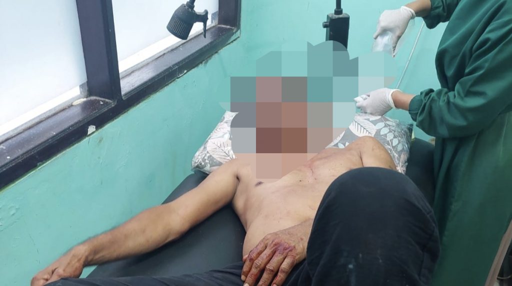 Cekcok Berujung 2 Pria Baku Hantam Babak Belur 1 Ditetapkan Tersangka, Begini Kronologinya