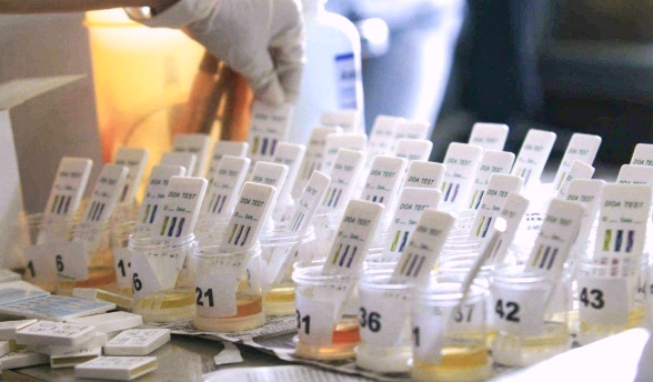 Alat tes urine narkotika