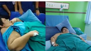 Fajri Pria Obesitas 300 Kg Meninggal Dunia di RSCM