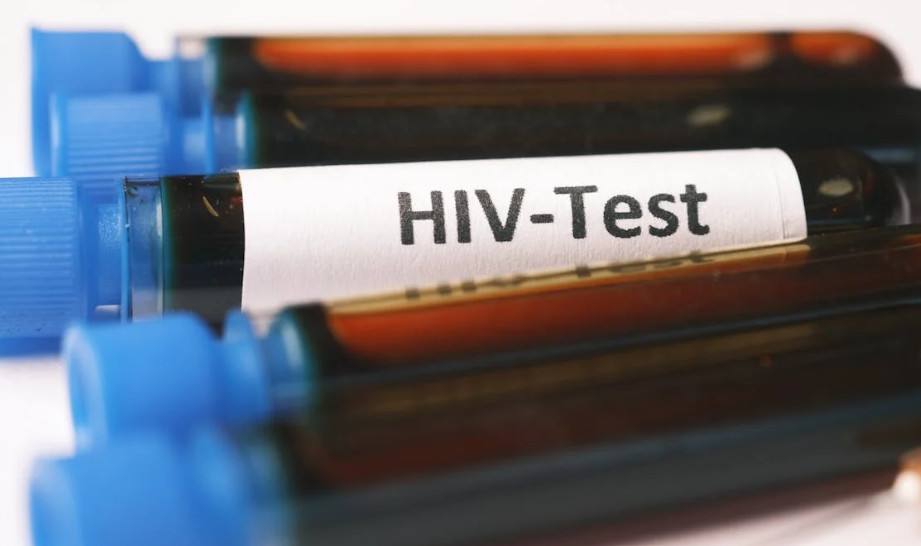 Presiden Trump Setop Pendanaan untuk HIV