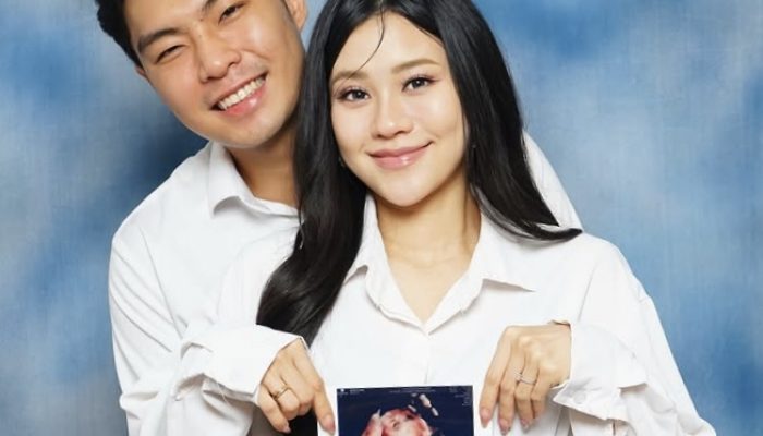 Jessica Jane Umumkan Hamil Anak Pertama, Pamer Foto USG Bersama Suami